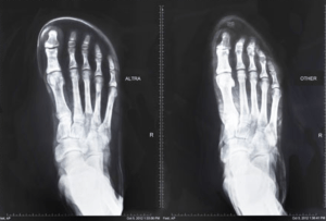 Altra X-Ray Image